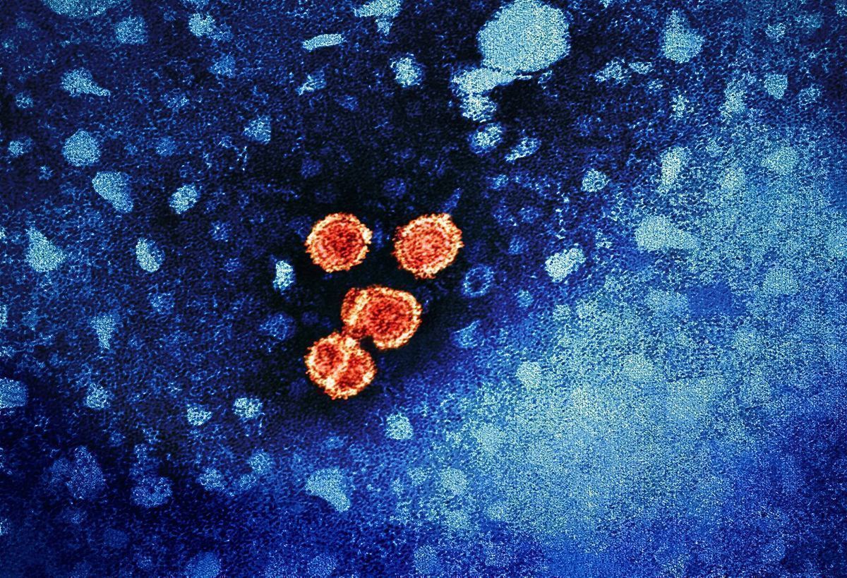 Colorized electron micrograph of round hepatitis B virus particles in red and yellow on a blue background